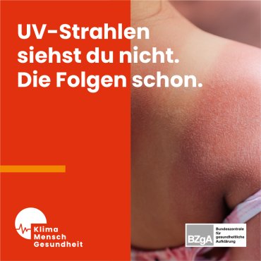 Eine Person mit sichtbarem Sonnenbrand.